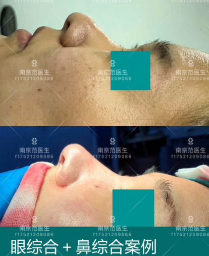 南京范家鑫做鼻子怎么样
